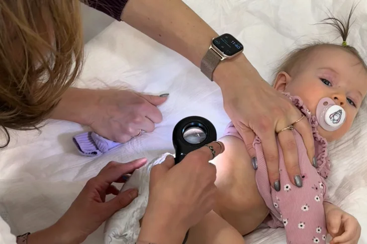 Child Rashes: When Definitely Need Turn to Dermatologist?