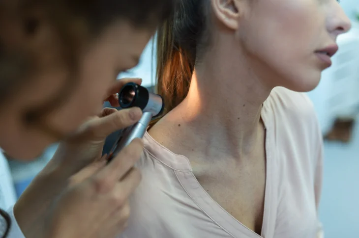 Moles Skin Formations: When Need Check?