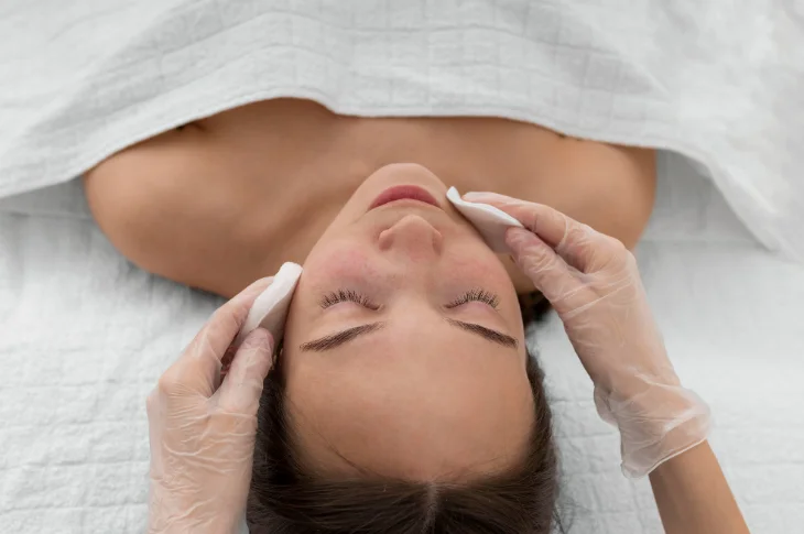 Kā ārstēt akni pieaugušajiem? Dermatologa ieteikumi