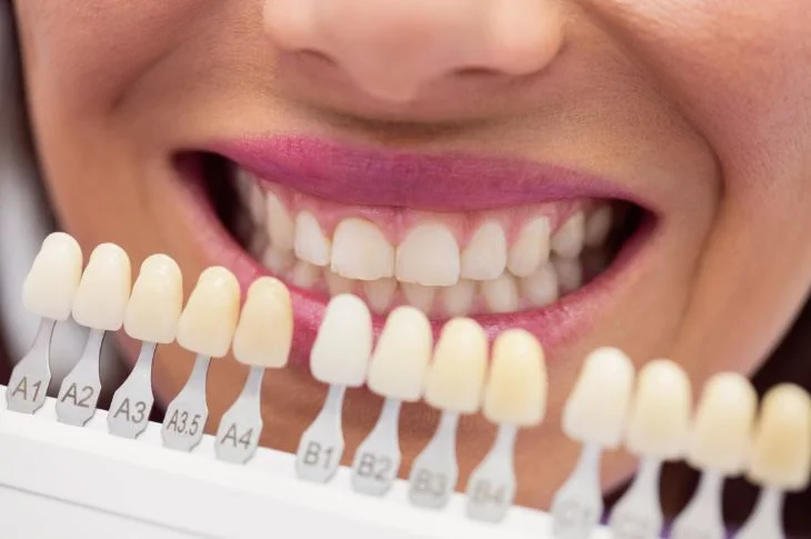 Teeth Whitening with ZOOM Technology