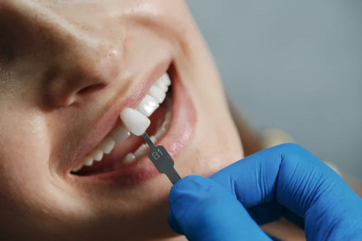 Advantages and Disadvantages of Dental Implants – Learn the Main Points