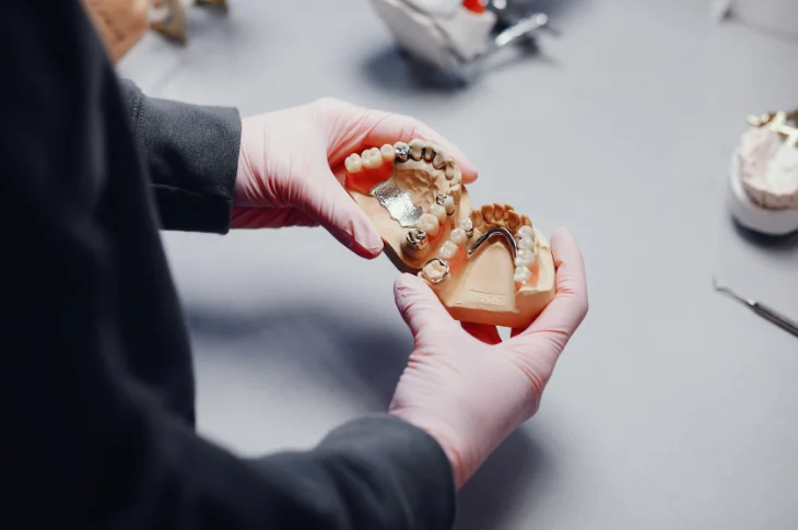 Dental Crowns or a Bridge: How to Choose the Best Solution?